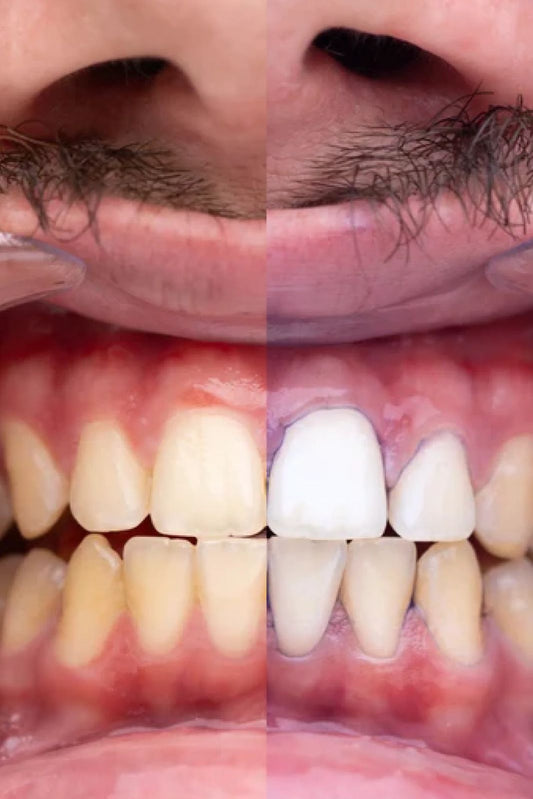 😁Renueva tu sonrisa con OBSESSIVE SMILE✨